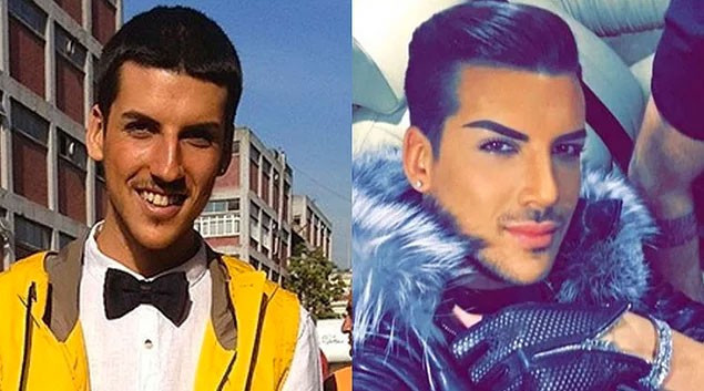 Estetik yaptırdı aynaya baksa kendini tanıyamaz hale geldi - Resim: 1