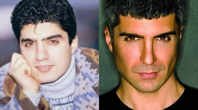 Estetik yaptırdı aynaya baksa kendini tanıyamaz hale geldi - Resim: 3