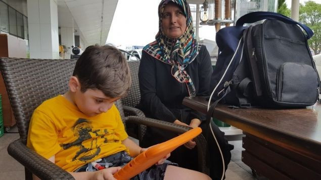 5 yılda tam 70 ameliyat geçirdi - Resim: 2