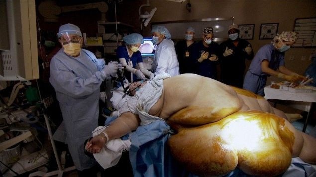 Parmağını kıpırdatamıyordu yarım ton kilo verdi değişim olay - Resim: 4