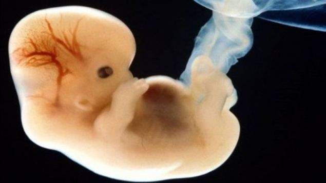 İnsan genleri değiştirildi: Tasarım bebekler eliyor - Resim: 2