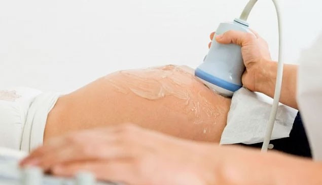 Anne karnındaki bebek tekmeleriyle rahim duvarını yırttı! - Resim: 2