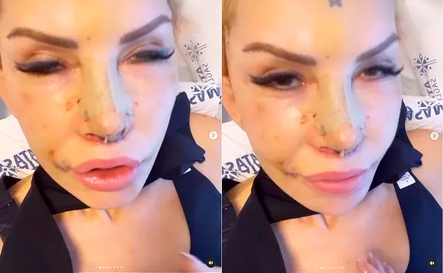 Filiz Akın'a benzemek için 10 ameliyat geçiren Sisi Seyhan Soylu'nun son haline bakın! - Resim: 3