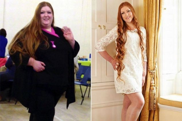 Banyoya sığamıyordu tam 115 kilo verdi sonuç müthiş - Resim: 2