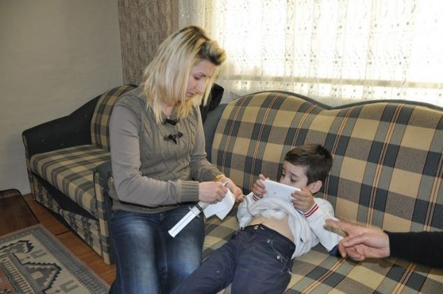 5 yılda tam 70 ameliyat geçirdi - Resim: 3