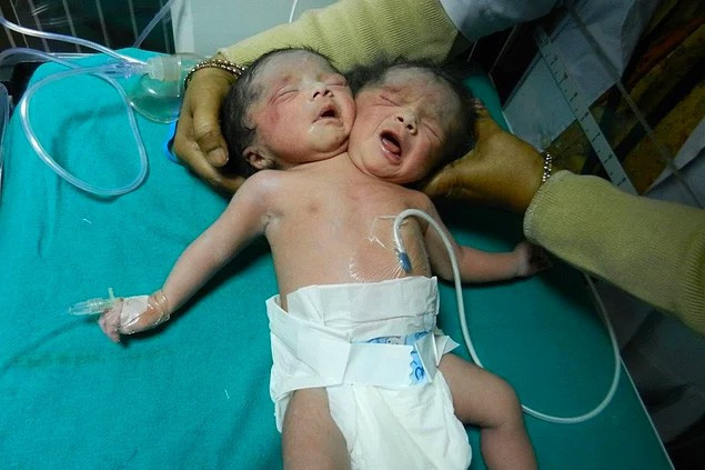 O gerçekten bir fil adam gözlerinize inanamayacaksınız! - Resim: 4