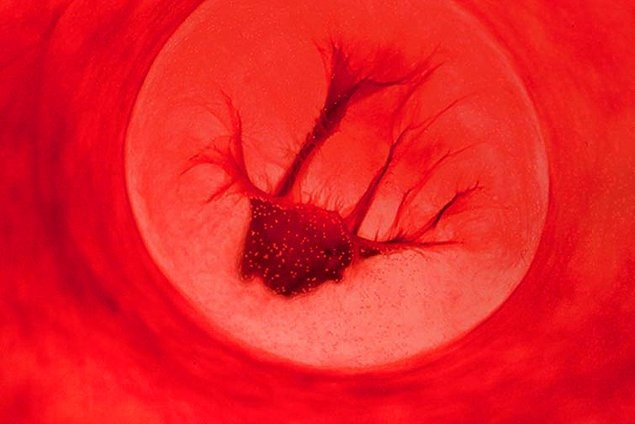 Regl kanıyla fotoğraf yaptı sanat eseri dedi! - Resim: 2