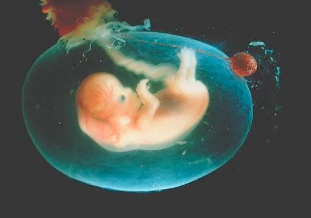 Anne karnındaki bebek tekmeleriyle rahim duvarını yırttı! - Resim: 3