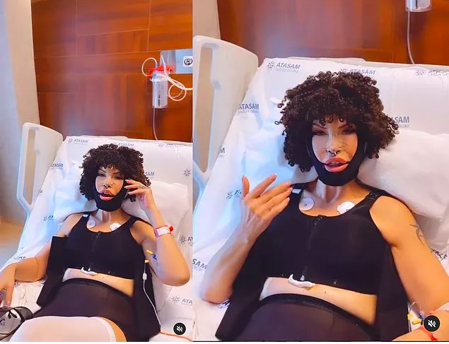 Filiz Akın'a benzemek için 10 ameliyat geçiren Sisi Seyhan Soylu'nun son haline bakın! - Resim: 4