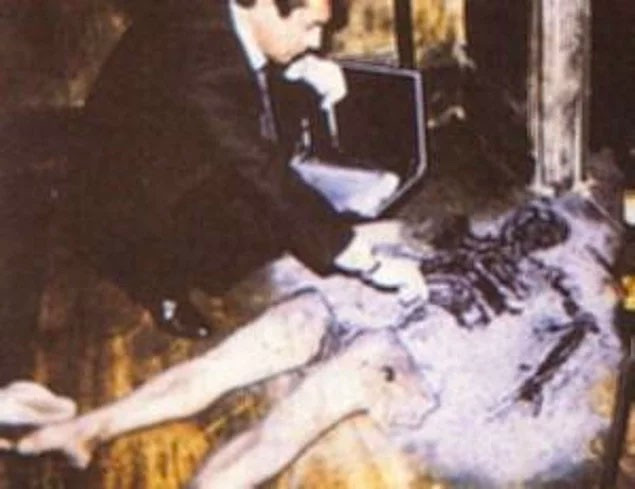 Kendi kendine yanarak öldü! Bilimin açıklayamadığı esrar - Resim: 4