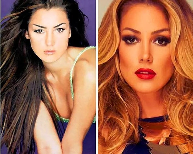 Estetik harikası ünlülerimiz - Resim: 4