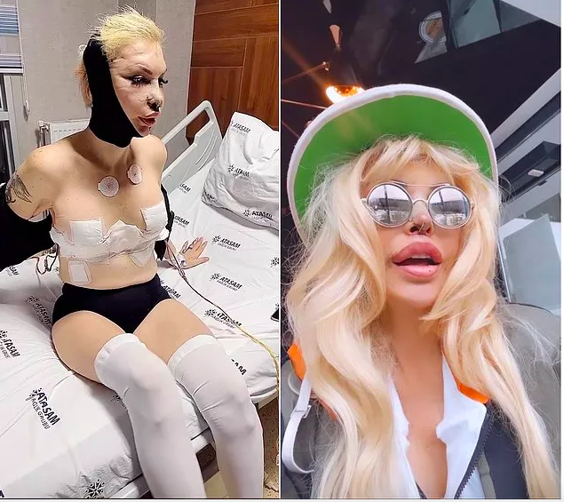 Filiz Akın'a benzemek için 10 ameliyat geçiren Sisi Seyhan Soylu'nun son haline bakın! - Resim: 1