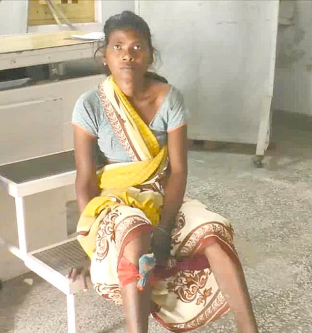 Doktorlar şaşkın iğne yumurtlayan kadından 70 tane iğne çıktı - Resim: 1