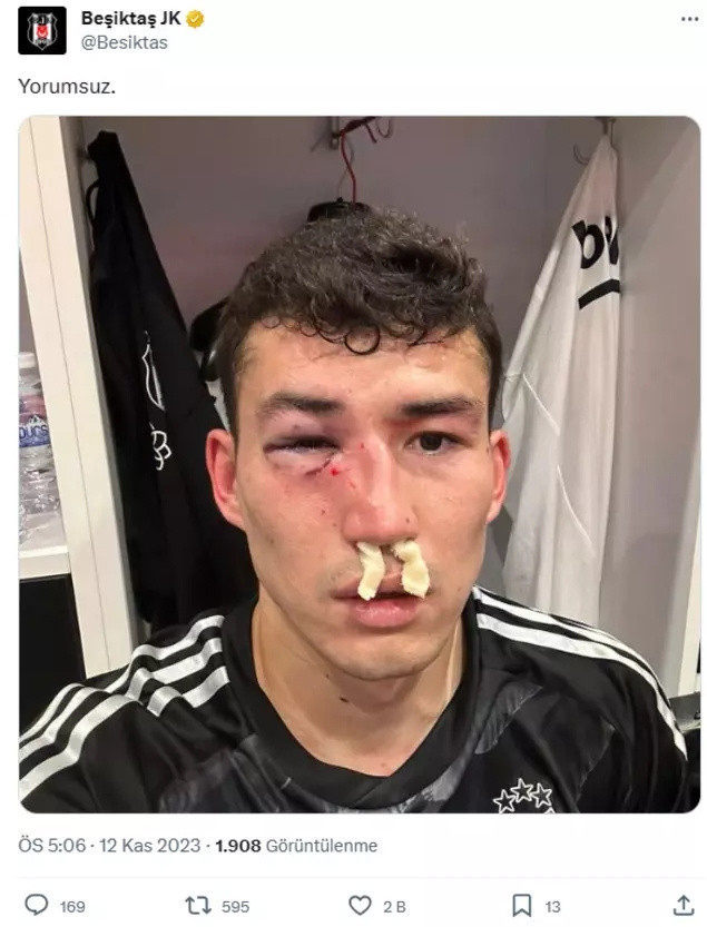 Beşiktaş taraftarı çıldırdı! Kaşı patladı, gözü morardı, burnu kırıldı... - Resim: 0