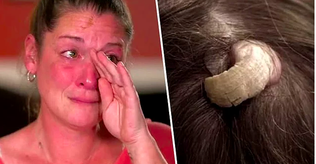 Kafasından boynuz çıktı! Görüntü tıp dünyasını ayaklandırdı! - Resim: 1