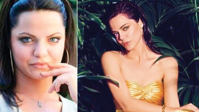 ATV Bir Zamanlar Çukurova oyuncusu Hilal Altınbilek estetik itirafıyla olay oldu! - Resim: 2