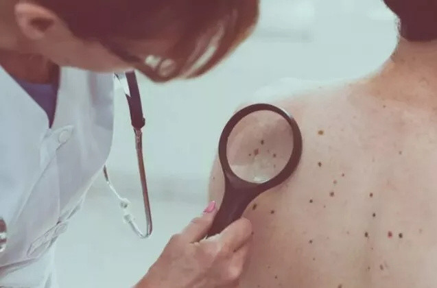 İşte hayatınızı karartacak 8 ölümcül kanser türünün belirtileri - Resim: 1