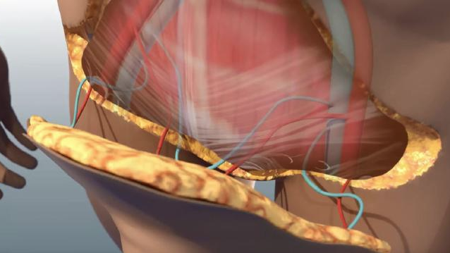 Mayına bastı cinsel organı paramparça oldu başka birinin organı... - Resim: 4