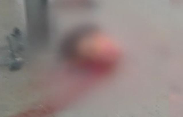 İstanbul'da korkunç kaza! Boğazına bariyer saplandı kafası koptu - Resim: 3