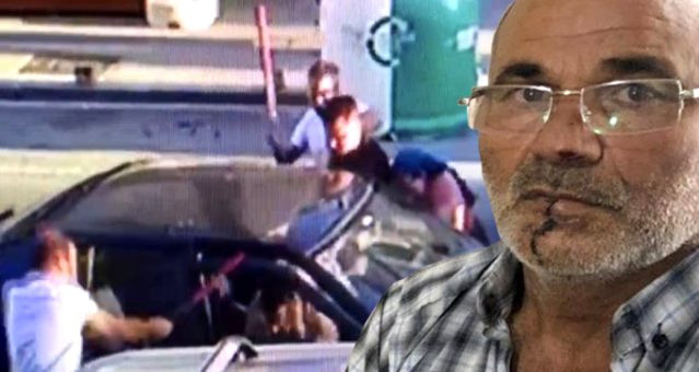 Yer Pendik! Kayınpederinin dudaklarını ısırarak kopardı resmen sokak savaşı - Resim: 0