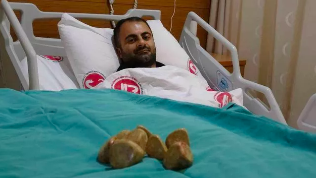 Karın ağrısı için hastaneye gitti karnından çıkanlar dumur etti! Gören kalakaldı - Resim: 1