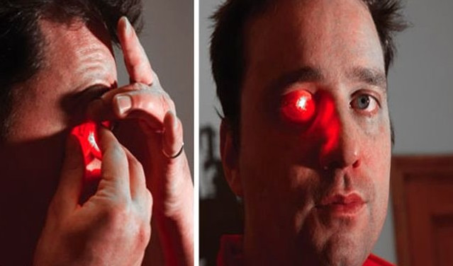 Gözünü çıkarıp yerine öyle birşey yaptı ki... - Resim: 2