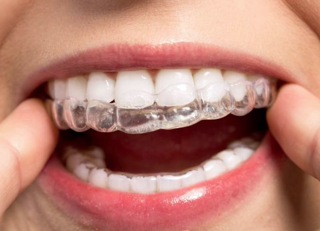 Diş telinden haz etmeyenlere müjde! Bu iki yöntemi deneyin - Resim: 4