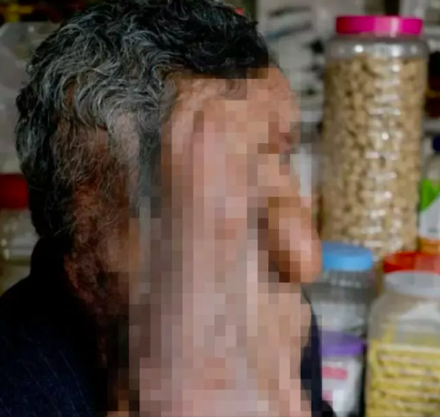 Yüzü günden güne eriyor! Öyle bir hastalığa yakalandığı ki... - Resim: 0