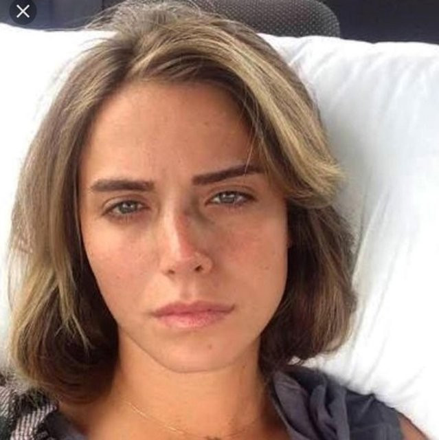 'Buyrun kırılan burnum' dedi Ceyda Ateş'ten olaylı yanıt! - Resim: 1