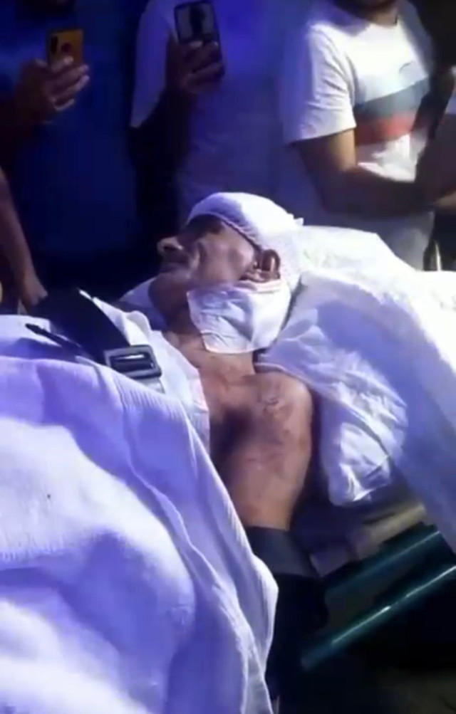 İstanbul'da fazladan istediği fişi vermeyen taksicinin falçatayla boğazını kesti - Resim: 0