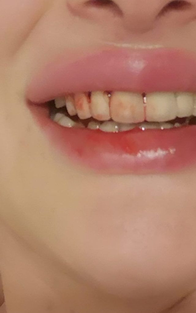 Ortaköy'de sevgilisinin dövdüğü Sırp modelden inanılmaz ifadeler - Resim: 2