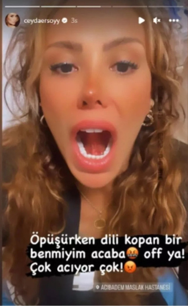 Ciciş Ceyda Ersoy'un öpüşürken dili koptu! Hastaneden olay paylaşım: "Bir ay öpüşmemiştik ama" - Resim: 1