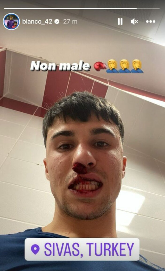 Sahaya atlayan taraftar İtalyan futbolcunun burnunu kırdı - Resim: 0