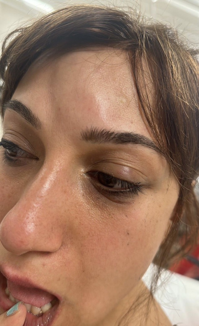 Taksim'de hastanede doktor dehşeti: Kadının gözüne yumruk attı! - Resim: 1