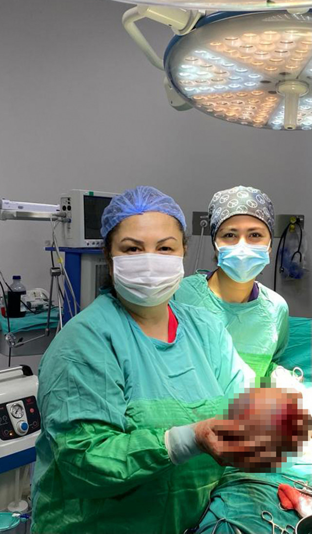 Antalya'da 56 yaşındaki kadının rahminden çıktı! Büyüklüğü şaşkınlık yarattı - Resim: 1