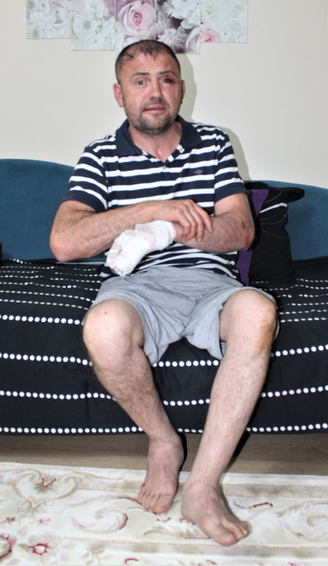 Bursa'da büyük terbiyesizlik gazi olduğunu söylemesine rağmen saldırdılar - Resim: 0