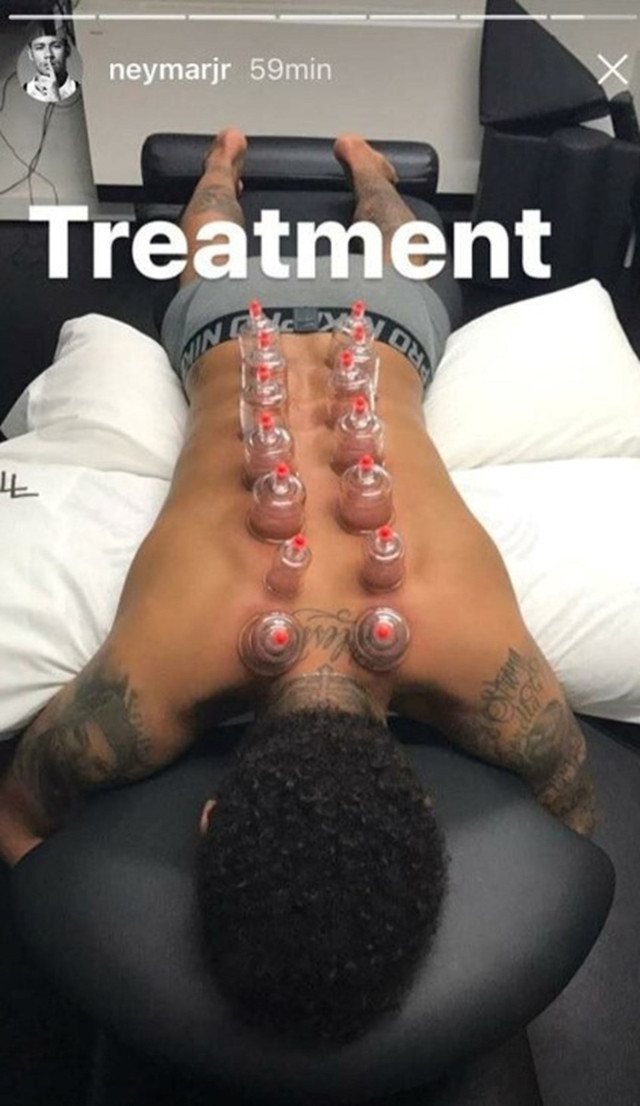 Karim Benzema hacamat yaptırdı “iyileşme” notunu düştü - Resim: 0