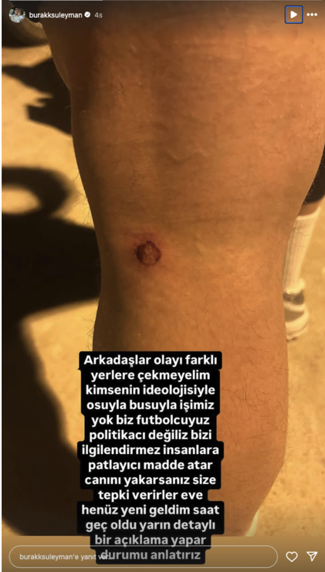 Burak Süleyman'dan Amedspor tribününe olay hareket! Ayağının halini paylaştı - Resim: 2