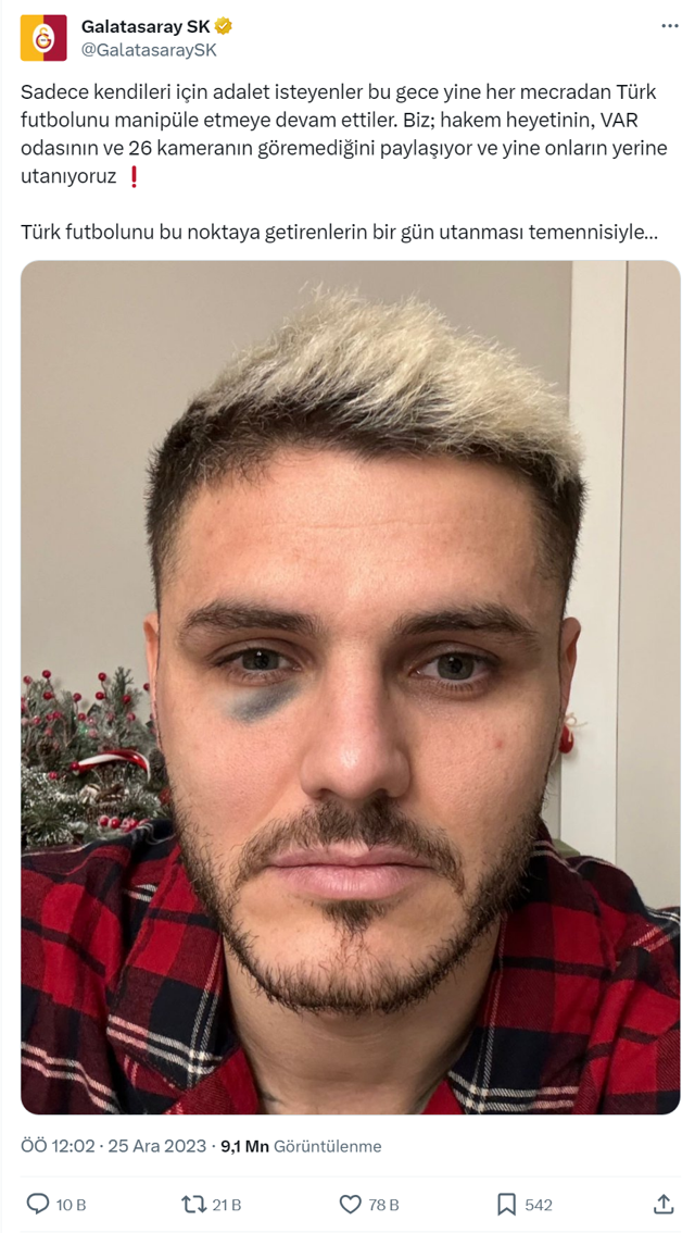 Derbi sonrası Fenerbahçe ile Galasataray Icardi için kapıştı! Dirsek mi morarttı direğe çarptığı için mi morardı - Resim: 0