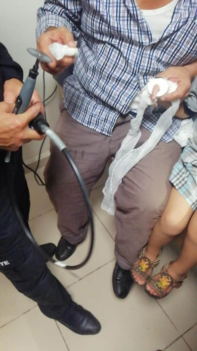 Çankırı'da parmağı metal halkaya sıkışan çocuğu itfaiye kurtardı! - Resim: 0