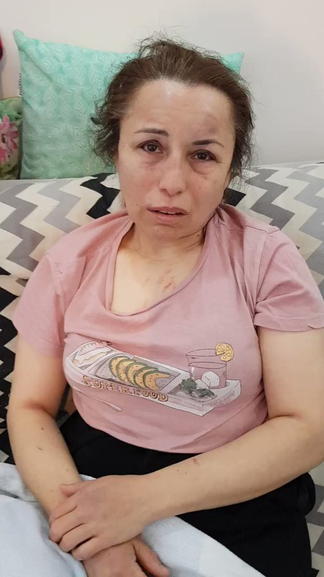 Ormana kaçırdı, dövdü, işkence yaptı: Ya benimsin ya ölekecsin - Resim: 1