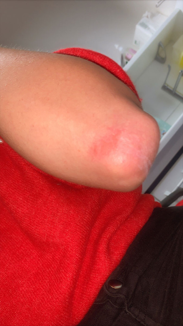 Fransa'da iki Türk genç kıza polis şiddeti - Resim: 0