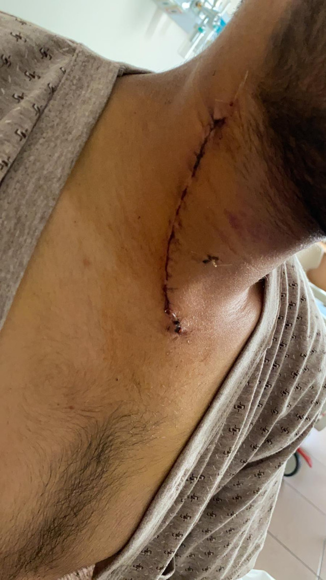 Ankara'da şah damarı kesilen işçi yüzde bir ihtimalle hayata tutundu - Resim: 1