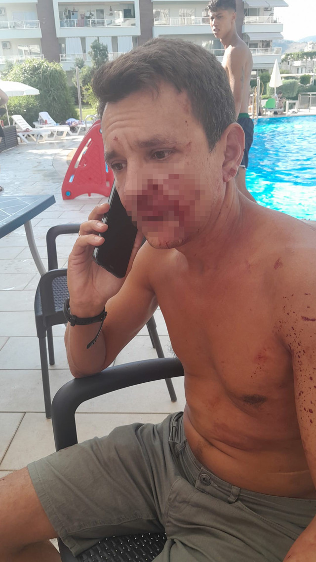 Alanya'da yaşayan Rus'u site yöneticisinin darbettiği iddiası - Resim: 0