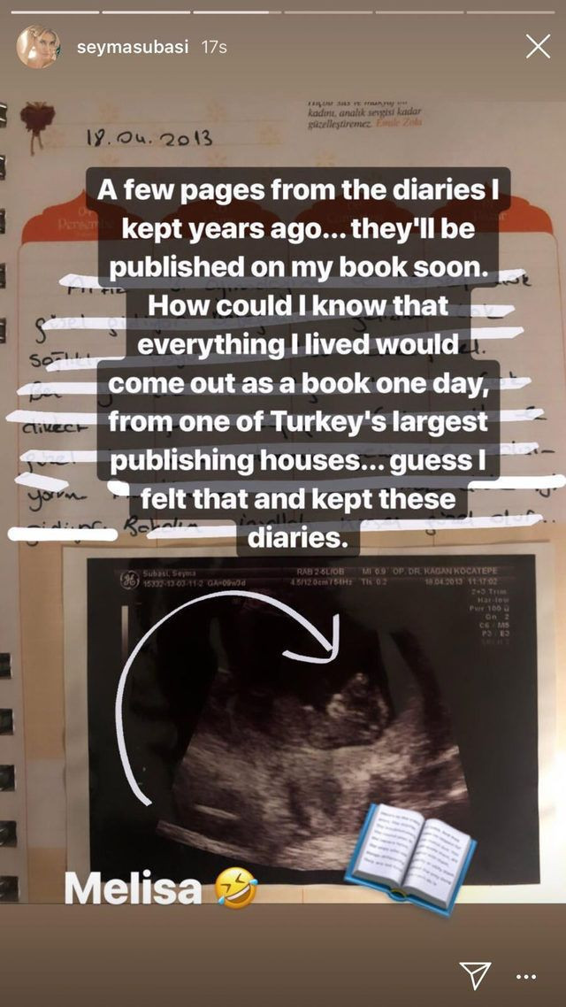 Şeyma Subaşı ilk kez bebeğinin ultrason fotoğrafını paylaştı! Sosyal medya karıştı - Resim: 3