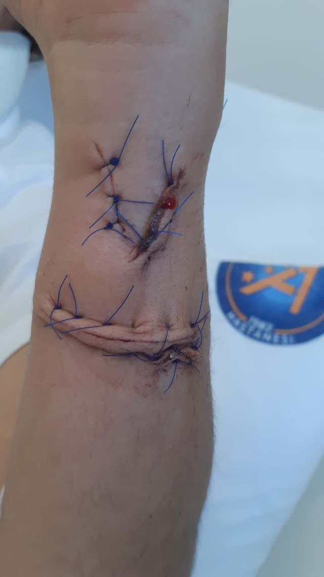 3 çocuk annesi olan eşinin boğazını kesen koca : Mart ayında geleceğim - Resim: 0