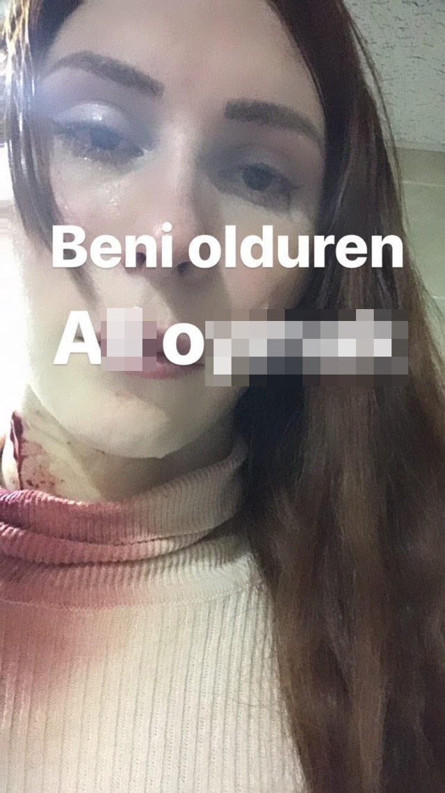Aydın'da boğazı kesilip öldürülmüştü katilin ismini kanlı fotoğrafla paylaşmış - Resim: 1