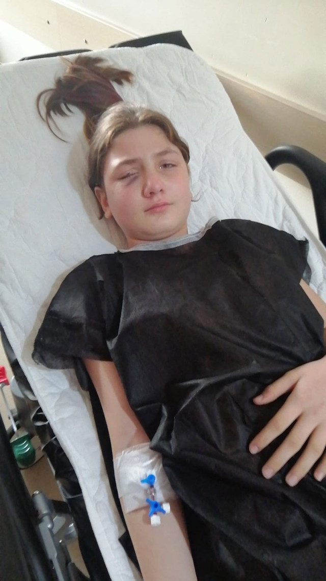 Aydın'da yaşandı! Yastık savaşı yaparken kırılan avize 9 yaşındaki kızın gözünü parçaladı - Resim: 0