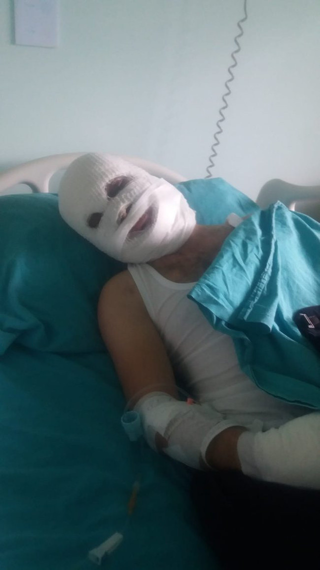 İstanbul'da korkunç olay! Sokak ortasında kezzapla saldırdı kör etti - Resim: 0