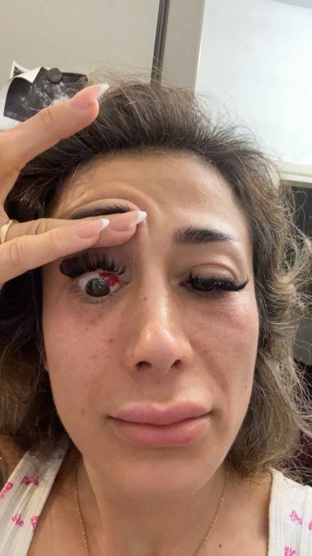 Fitness eğitmeni tavuk döner yedi! Gözü bu hale geldi - Resim: 0